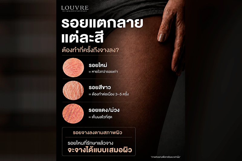 รอยแตกลาย...แต่ละสี