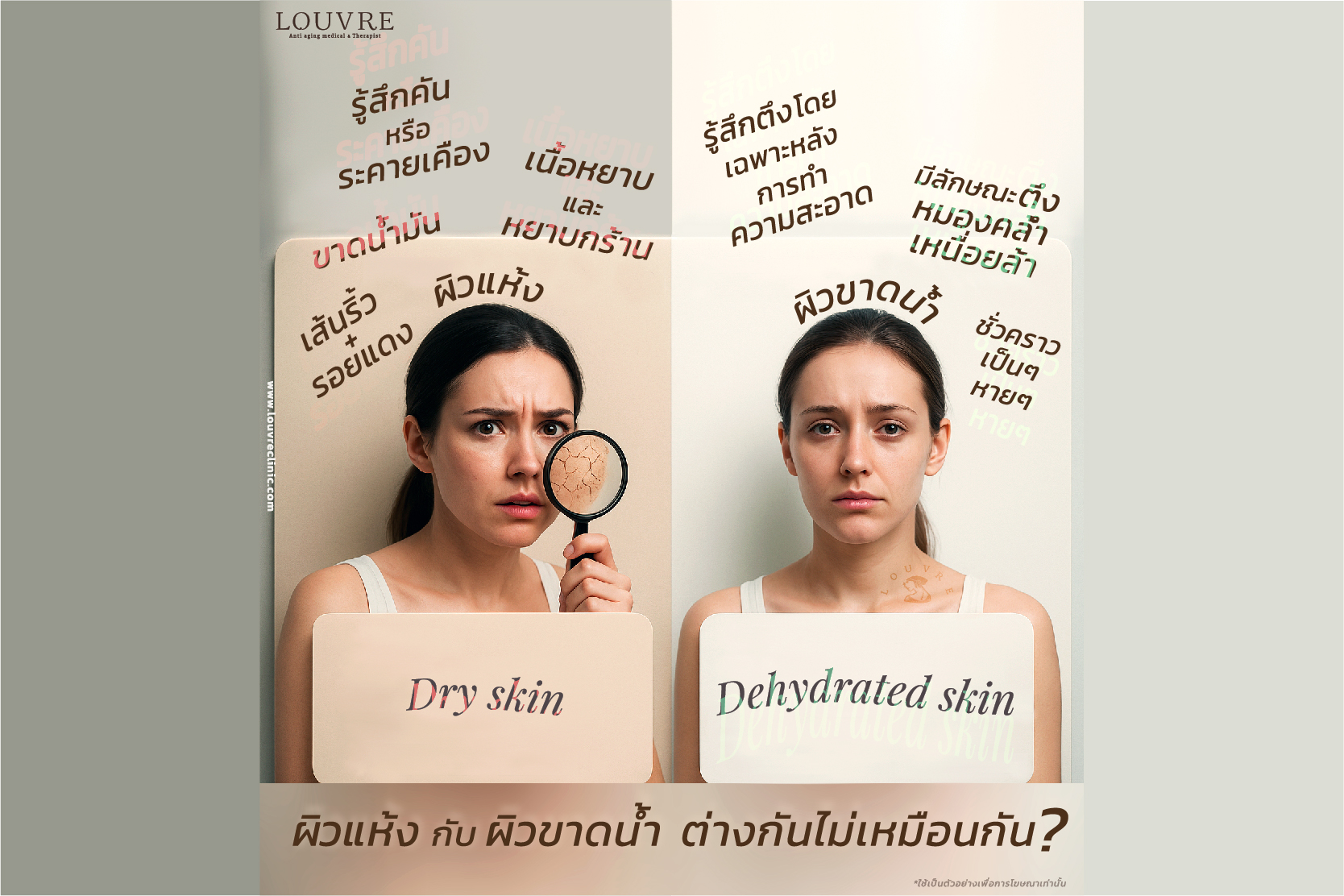 Dry skin and Dehydrated skin