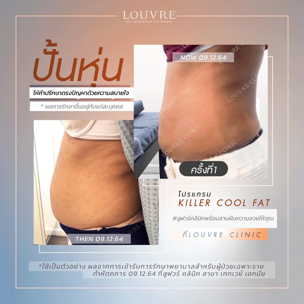 รีวิว-5